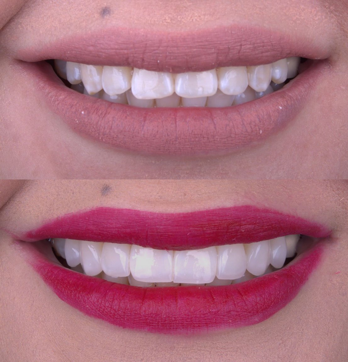 Caso 7 - Antes y Después